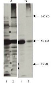 "
A. Western blot using Exalpha’s anti 3-nitrotyrosine monoclonal antibody (Cat # X1719M) on 40 µg mouse brain lysate (Lane 1) and 40 µg rat brain lysate (Lane 2). Antibody used at a dilution of 1µg/ml, detected with Supersignal West Pico  Substrate-30 second exposure.
B. Same experiment blocked with buffer containing 1 mM 3-nitrosine."